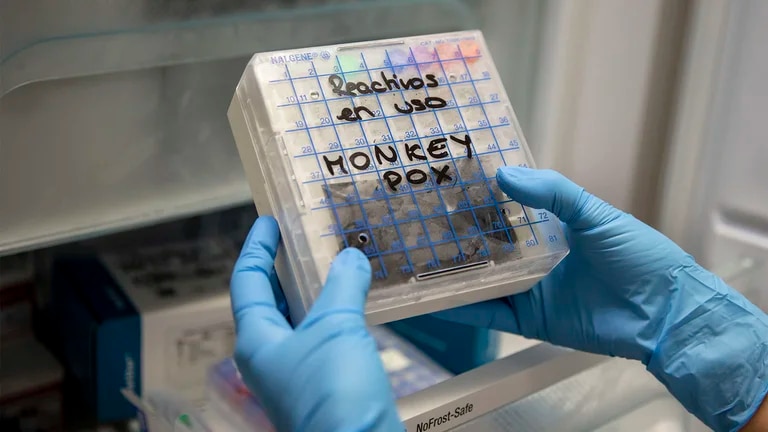 Confirmaron primer caso de viruela del mono en Rosario